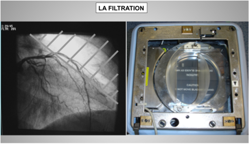 HSRG Capuchon De Plomb De Protection Contre Les Rayonnements X, Département  De Radiologie Radiation Ionisante Capuchon De Plomb pour Le Visage Exposé